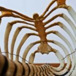 early onset arthritis