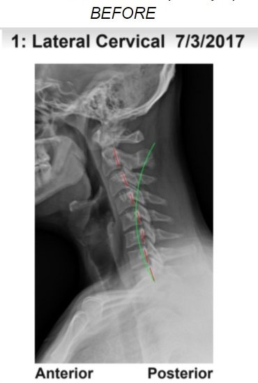Spine