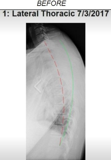 Spine