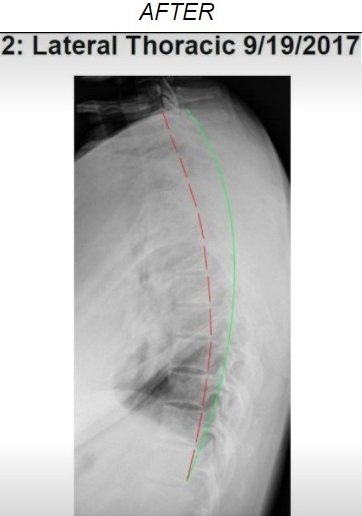 Spine