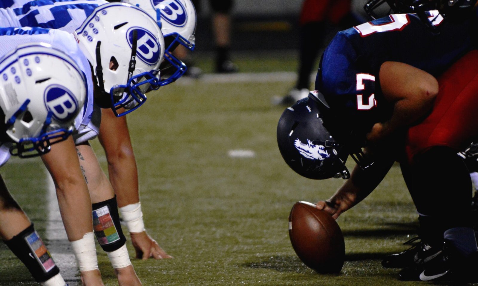 Are Concussions Sexist? 1 concussions