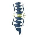 weakened spinal ligaments - steroid injection