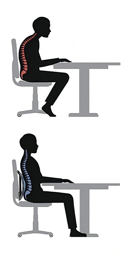 bad posture